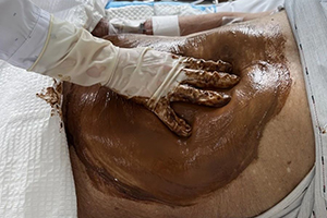 肿瘤中医摩腹